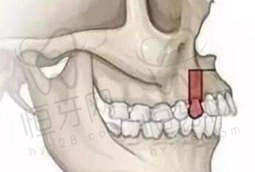 北京维乐口腔医院正规资质解析