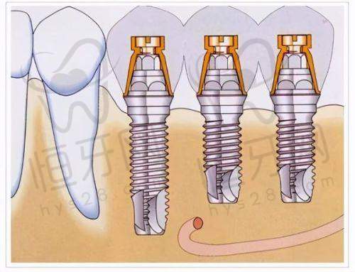 北京劲松口腔医院VS金科口腔门诊部资质大PK