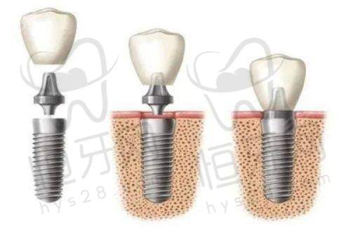 北京维乐口腔医院坐几号线?酒仙桥总院12/14号线任你选