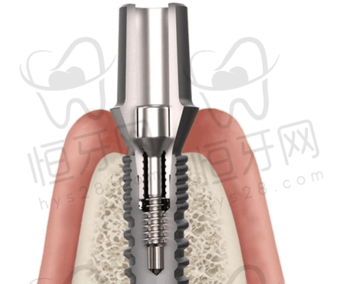 北京劲松口腔医院服务是海底捞式吗?