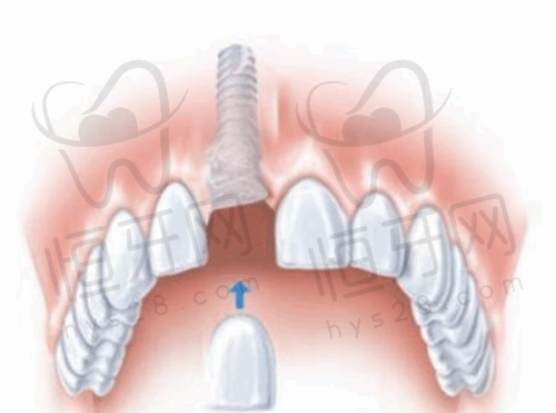 北京维乐口腔医院资质等级解析:二级总院+7家门诊部的连锁口腔机构