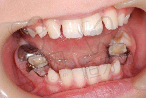 北京劲松口腔其他项目价格一览