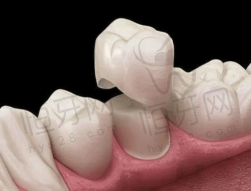 2026北京劲松口腔医院最新价目表:种植牙/矫正/补牙价格一览