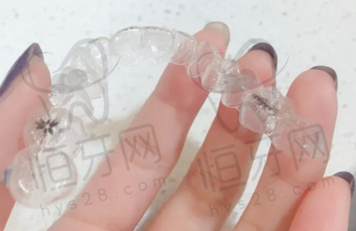 北京劲松口腔医院其他项目价格彩蛋