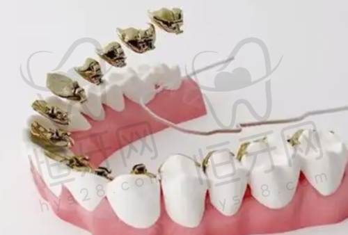 北京维乐口腔医院正规吗?资质、医生、价格全解析