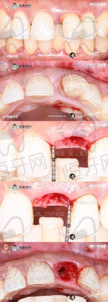 北京劲松口腔医院收费有多透明？价目表给你扒透了