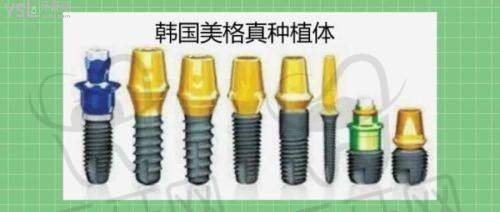 北京劲松口腔医院靠谱吗?正规资质+名医坐诊,种植牙3980元起