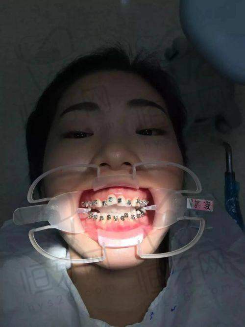 北京维乐口腔医院特色项目预约技巧