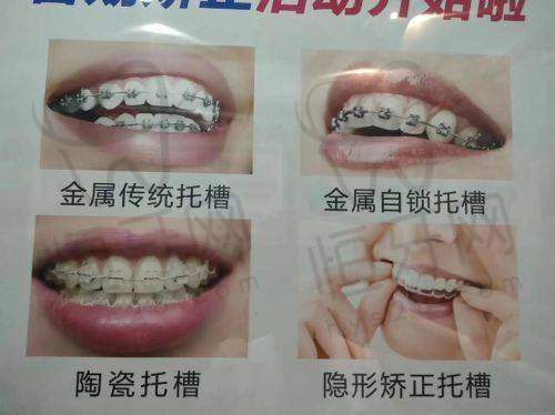 北京劲松口腔医院各分院特色对比