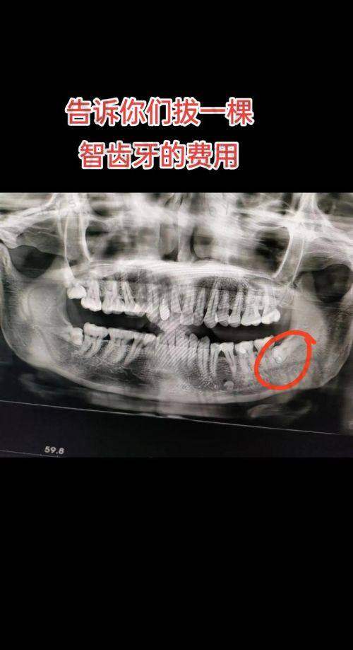 北京劲松口腔医院价格透明吗？2025价目表大公开