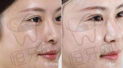 北京劲松口腔医院和金科口腔门诊部特色项目测评