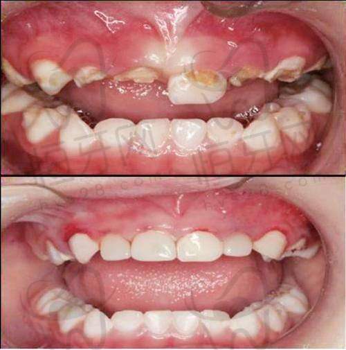 北京维乐口腔医院价格透明吗？