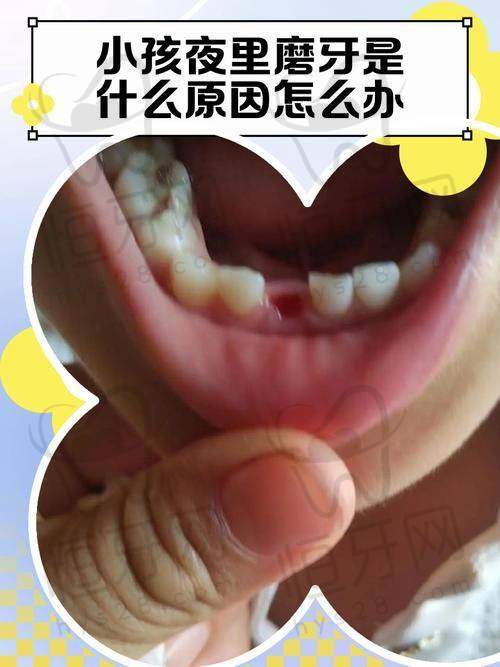 北京劲松口腔医院预约注意事项