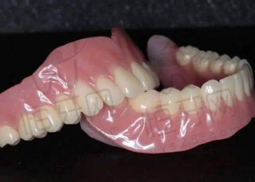 西安全口种植牙避坑指南