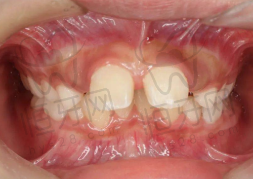 选择全口种植牙医院的核心标准