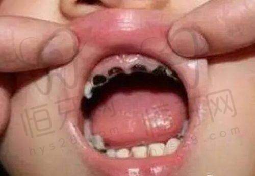 三、选择建议——按需挑选,种好牙不纠结