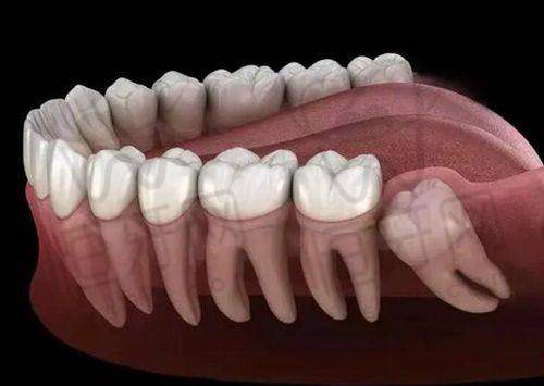 5. 北京中诺口腔