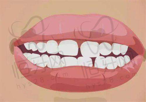 北京极简海德堡口腔十里河总院怎么走更省时?