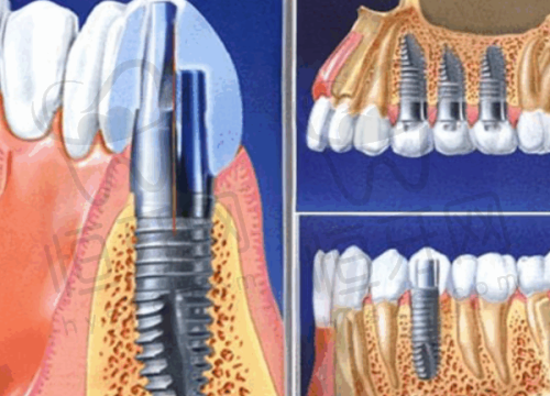 北京极简海德堡口腔特色项目推荐
