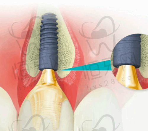 八、上海长征医院口腔科