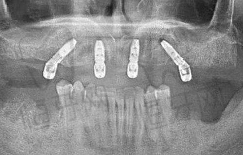十、上海第一人民医院口腔科