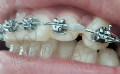 四、上海口腔病防治院