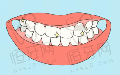 【上饶信州天使牙博仕口腔医院参考价格表:】