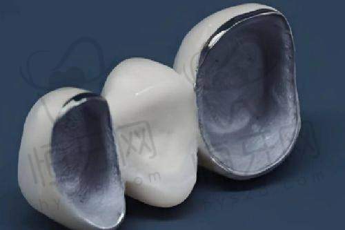 【南昌西湖摩尔口腔医院特色项目:】