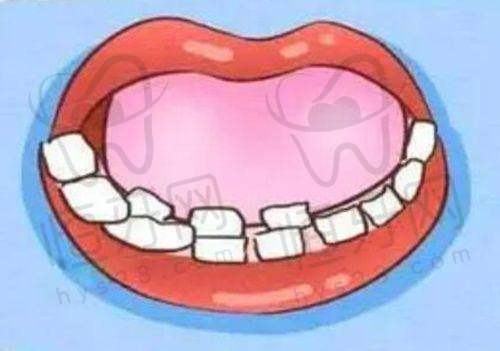 北京极简海德堡口腔医院:德系精准种植+智能隐形矫正,价格透明无隐形消费