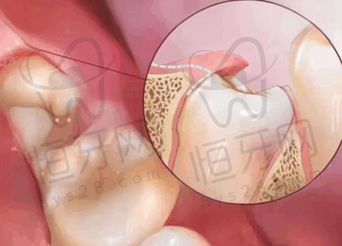 【上饶信州天使牙博仕口腔医院是正规的吗?】