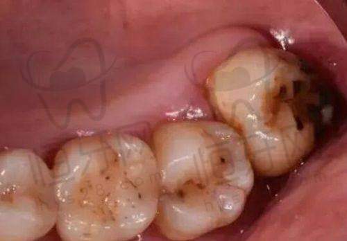 【吉安皓靓口腔门诊部(遂川店)特色项目:】