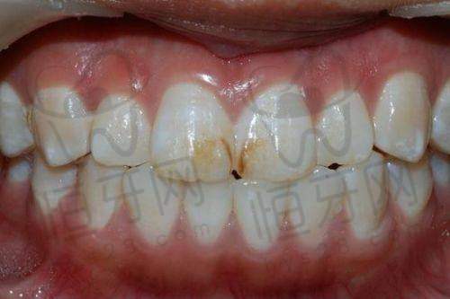 【上饶信州天使牙博仕口腔医院诊疗设备:】