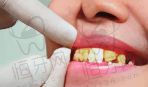 【南昌博德口腔门诊部(绿滋肴潮阳里店)诊疗设备:】