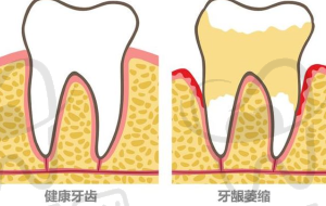 北京极简海德堡口腔智能隐形矫正:像拆盲盒一样有趣
