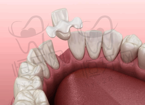【赣州贝壳口腔门诊部(宝能城分院)参考价格表:】