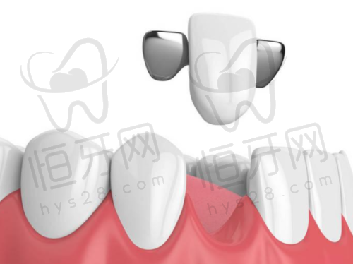 【南昌西湖摩尔口腔医院是正规的吗?】