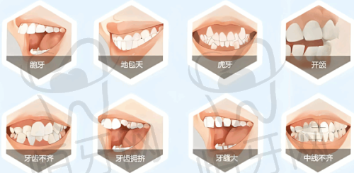 【赣州阳之光口腔门诊部(张家围店)诊疗设备:】