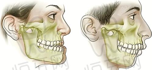 2026北京海德堡口腔医院价格表：种植牙2680元起，矫正4980元起（含4大分院）