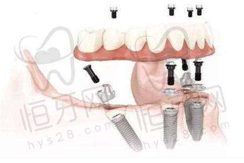 【赣州贝壳口腔门诊部(宝能城分院)核心优势:】