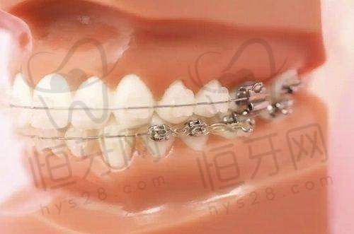 【南昌西湖摩尔口腔医院医生名单:】