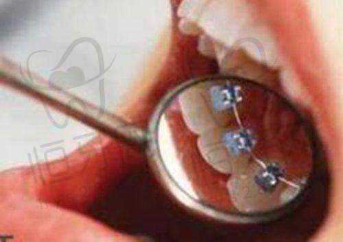 【南昌摩尔齿科(恒茂梦时代广场店)怎么预约挂号?】