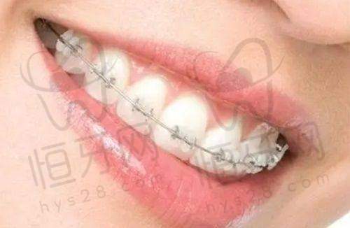 【赣州阳之光口腔门诊部(沙河店)怎么预约挂号?】