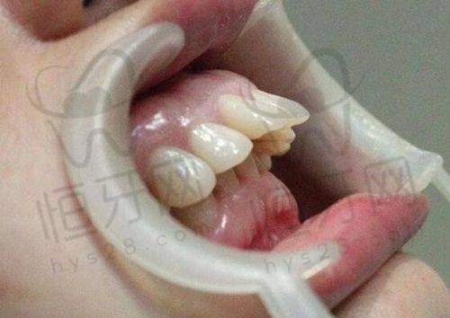 【吉安尚品口腔门诊部(广场院)医生名单:】