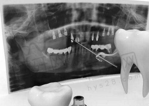 北京极简海德堡口腔的收费贵不贵