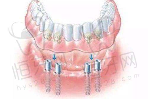 【  宜春泰康拜博口腔医院核心优势:】