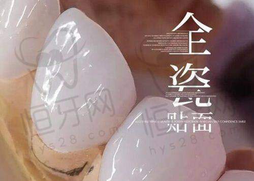 北京极简海德堡口腔种植牙价格表