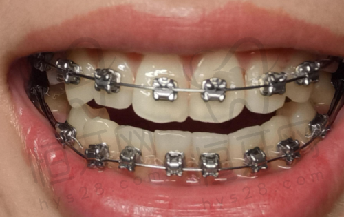 【赣州贝壳口腔门诊部(宝能城分院)怎么预约挂号?】