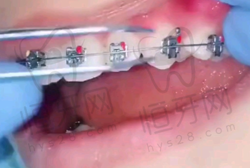 【南昌博德口腔门诊部(绿滋肴潮阳里店)怎么预约挂号?】