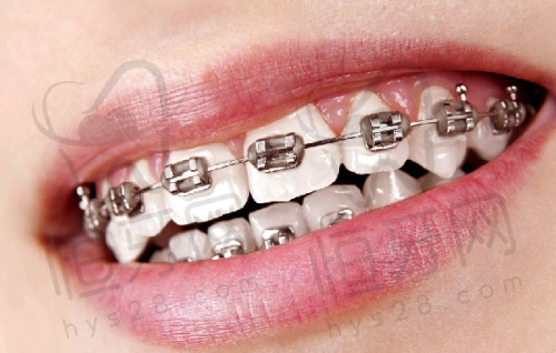 【吉安皓靓口腔门诊部(遂川店)怎么预约挂号?】