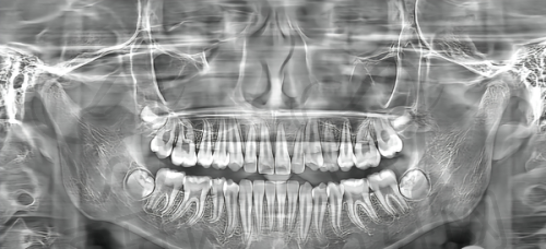 【南昌西湖摩尔口腔医院参考价格表:】
